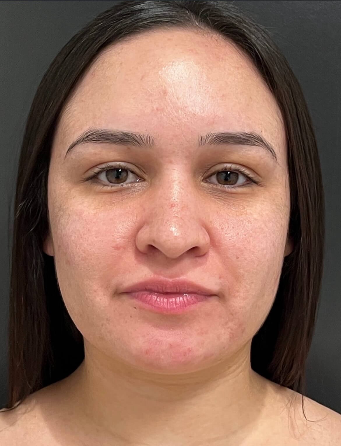 Sculpted, Smooth, & Stunning Before