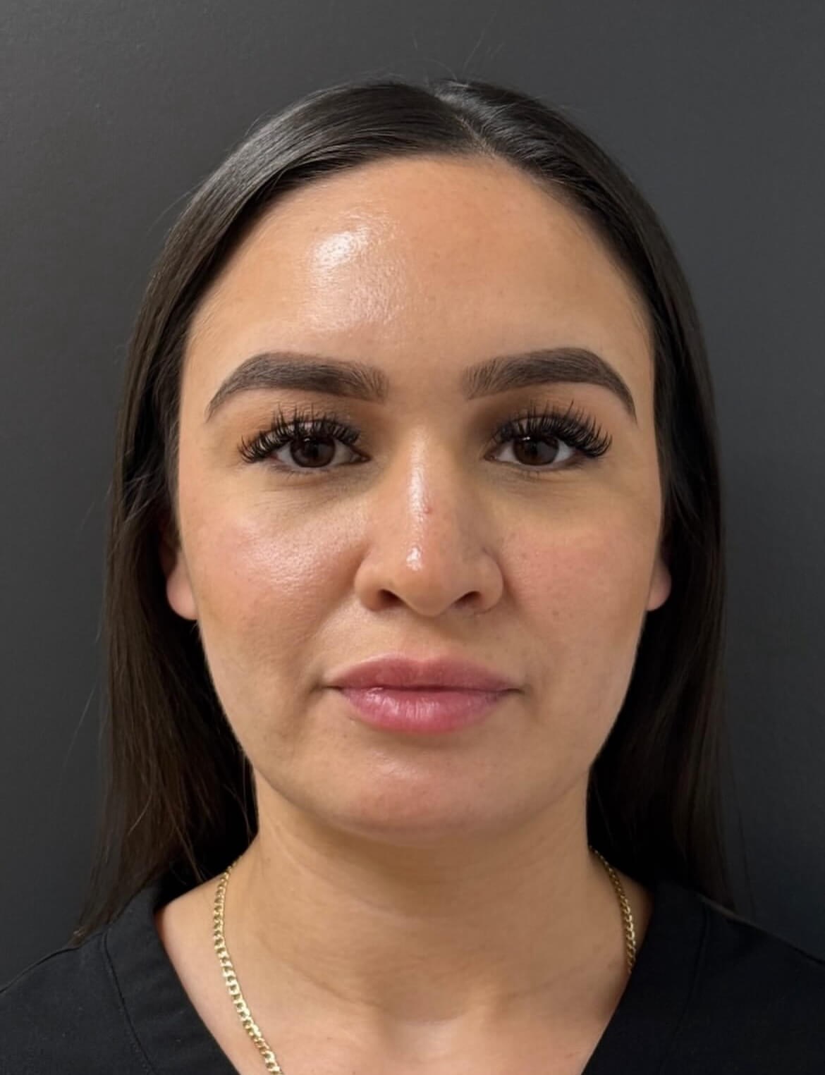 Sculpted, Smooth, & Stunning After