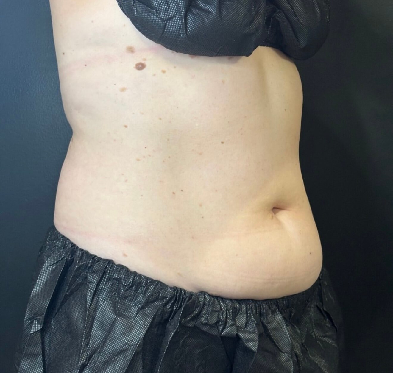 Sculpted to Perfection Before