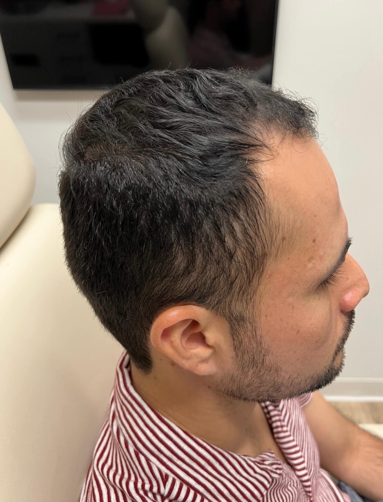 Thicker Hair with Vitti After