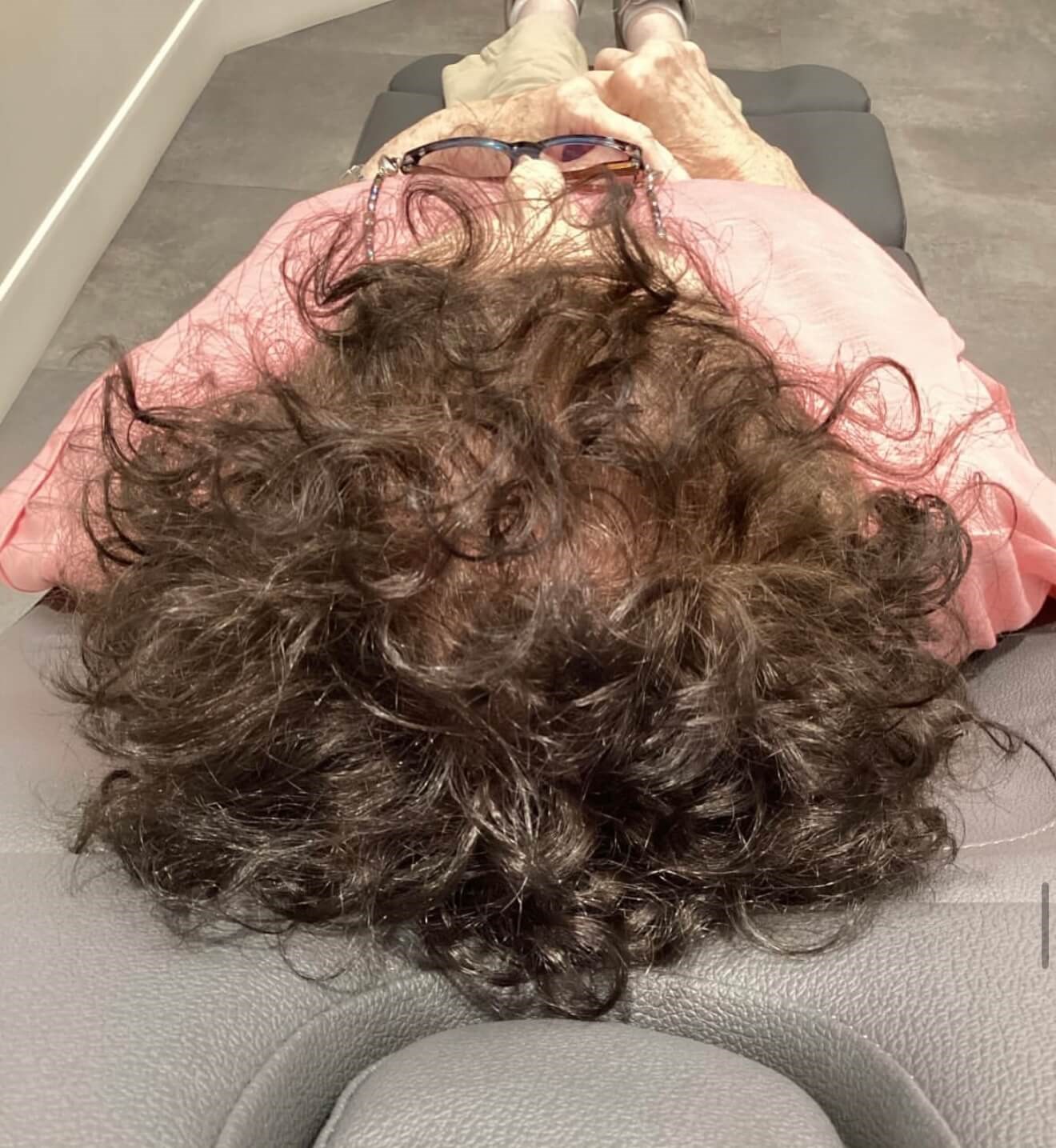 Hair Restoration Reveal After