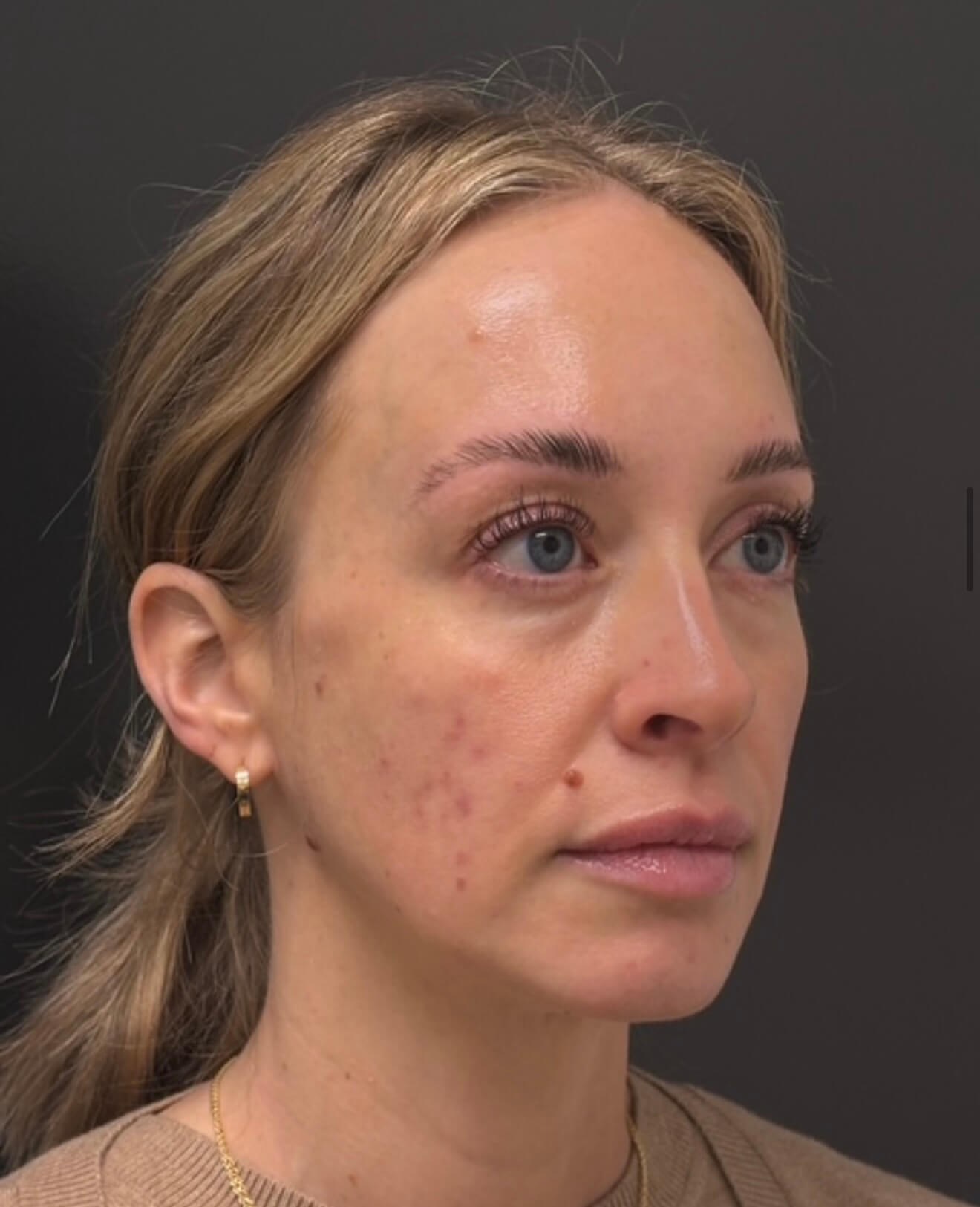 Full Face Refresh Before