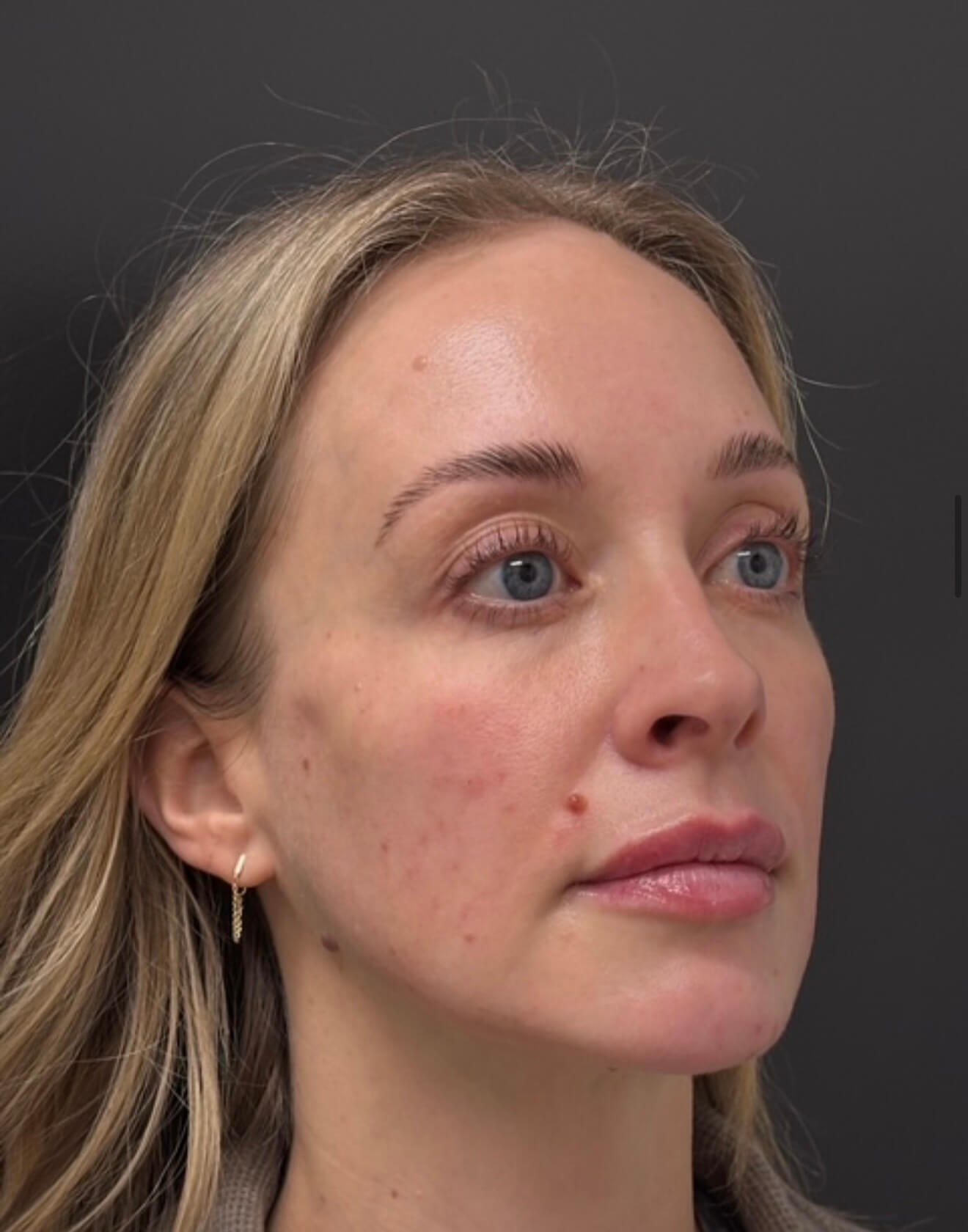 Full Face Refresh After