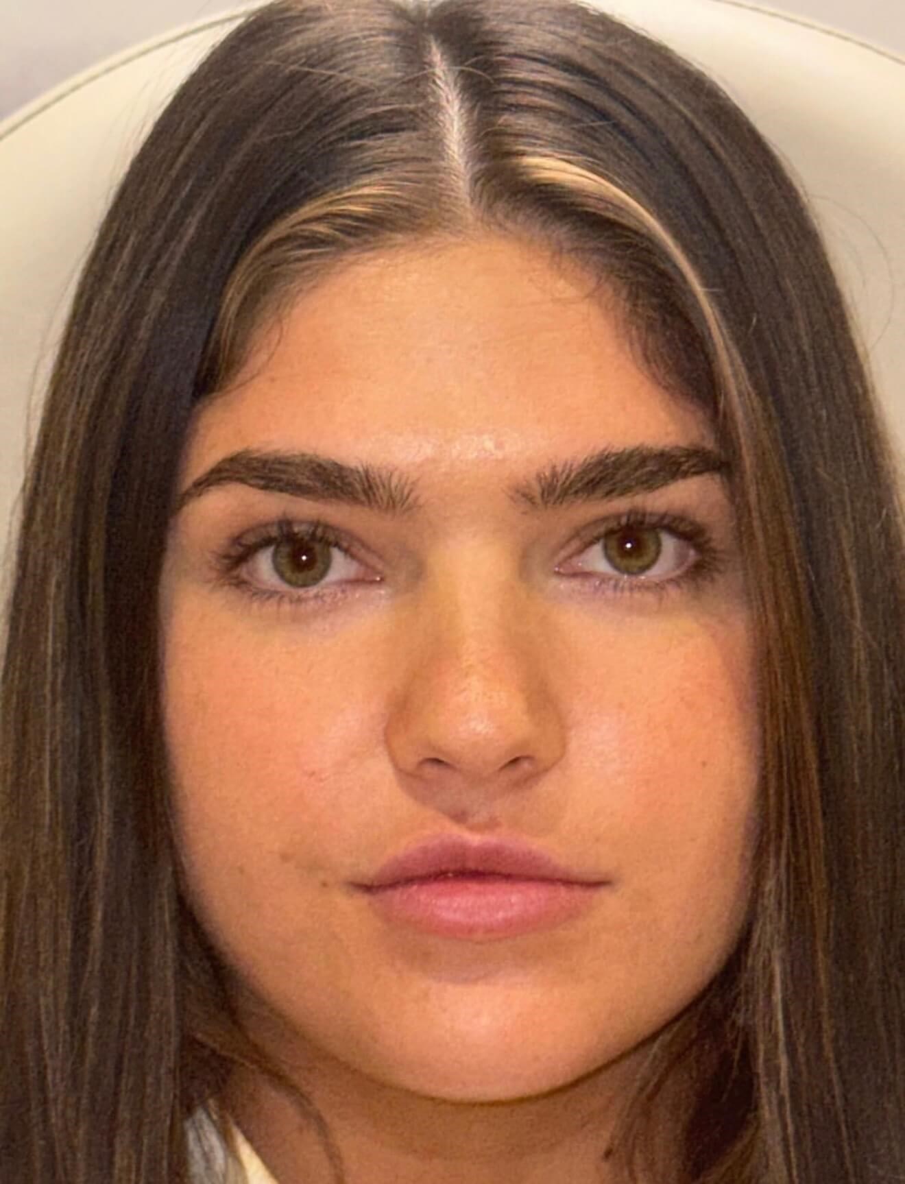 Plump & Perfect Lips Before