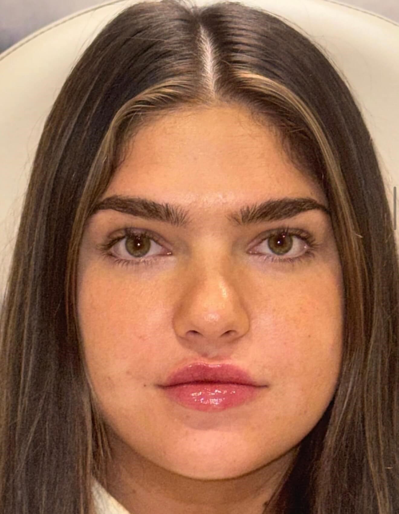 Plump & Perfect Lips After