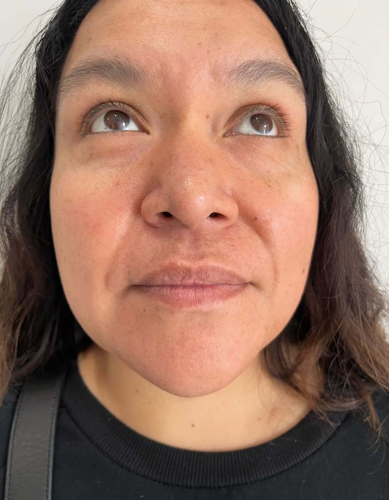 Kysse Lip Plump Before