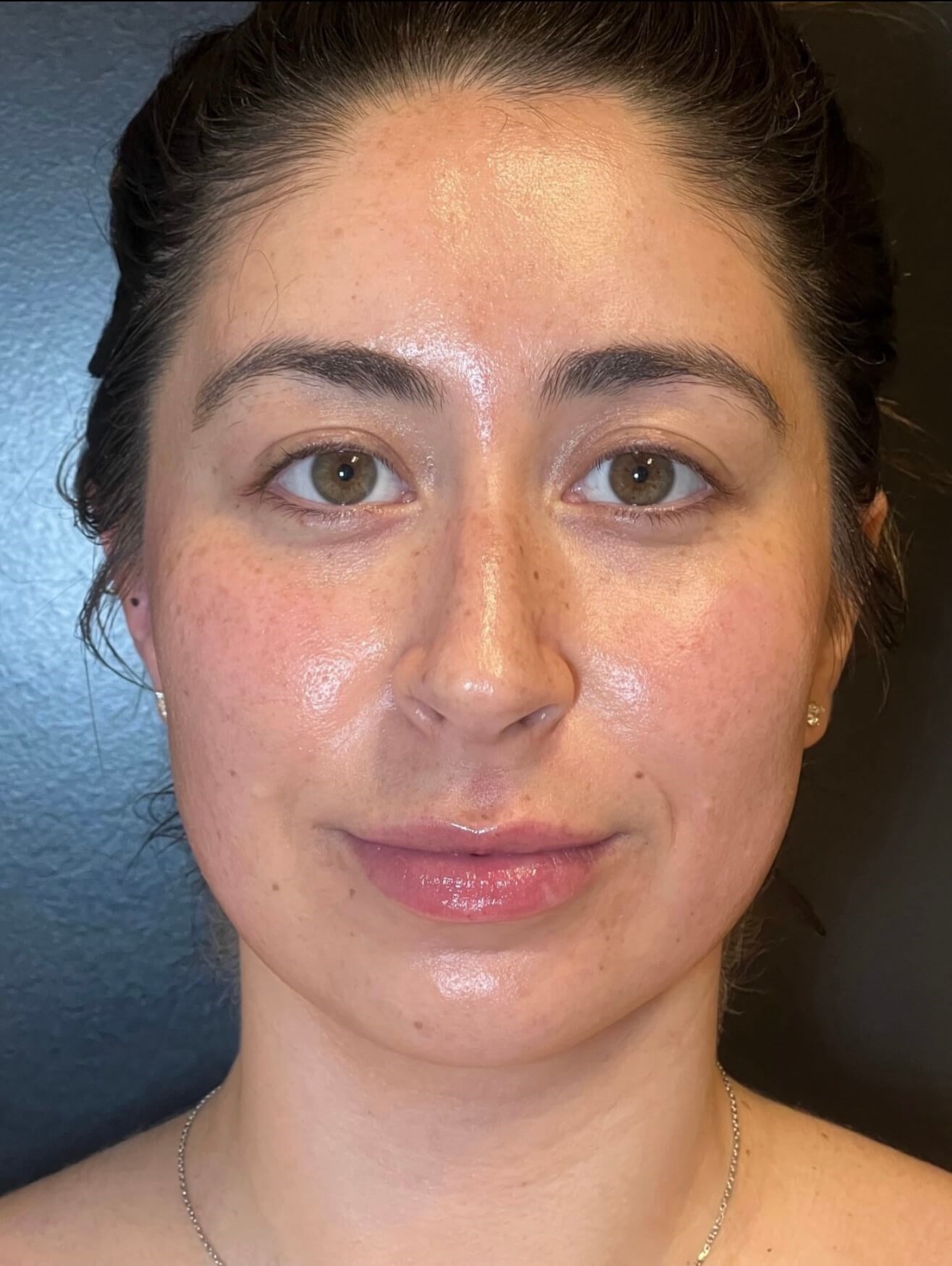 DiamondGlow Skin Renewal After