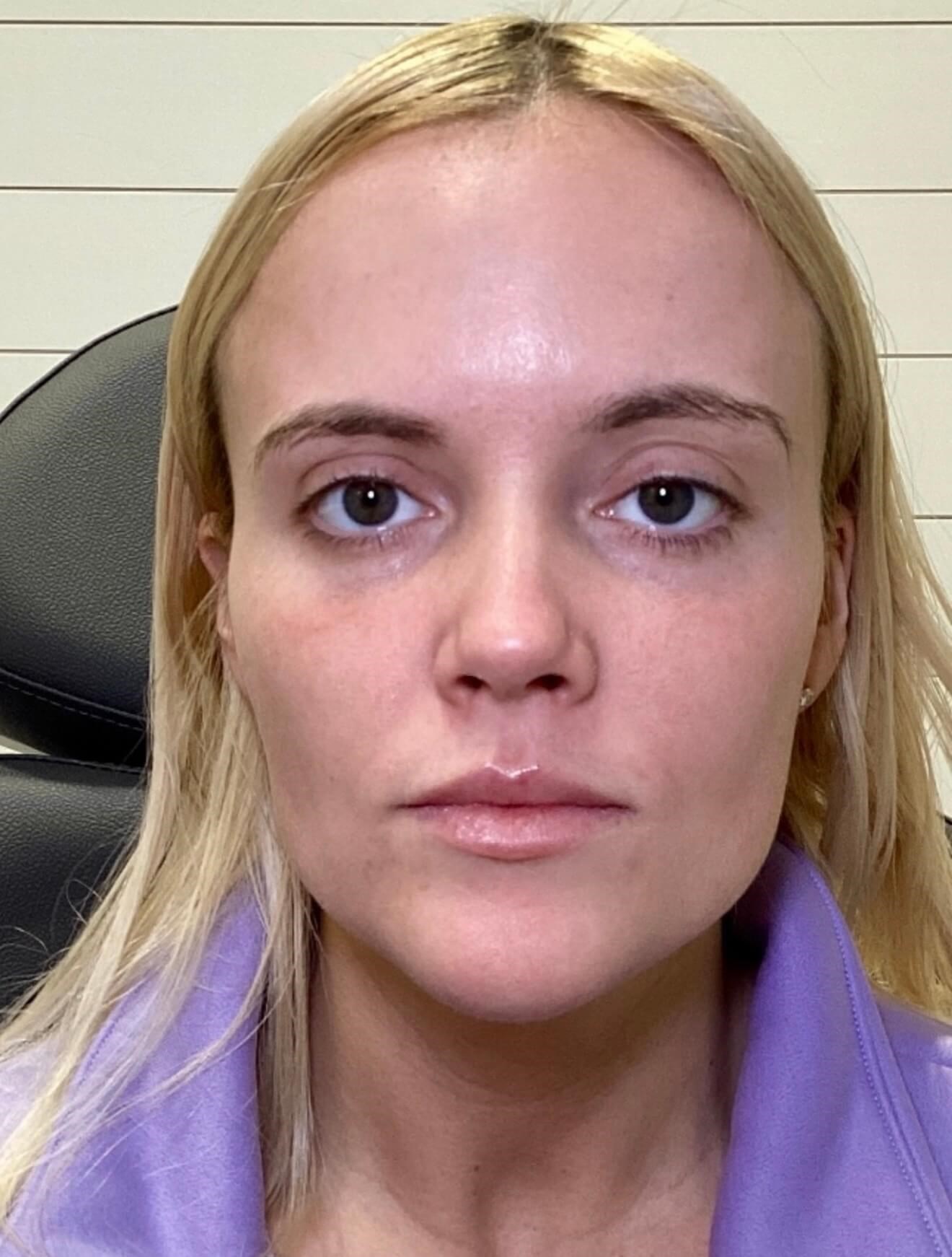 Head-to-Toe Transformation After