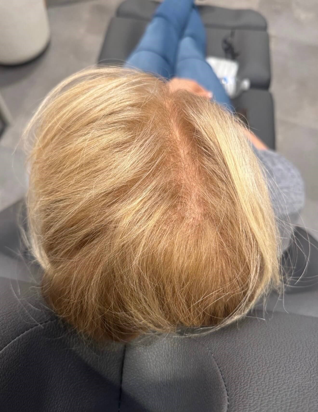 Revitalized Hair Growth After