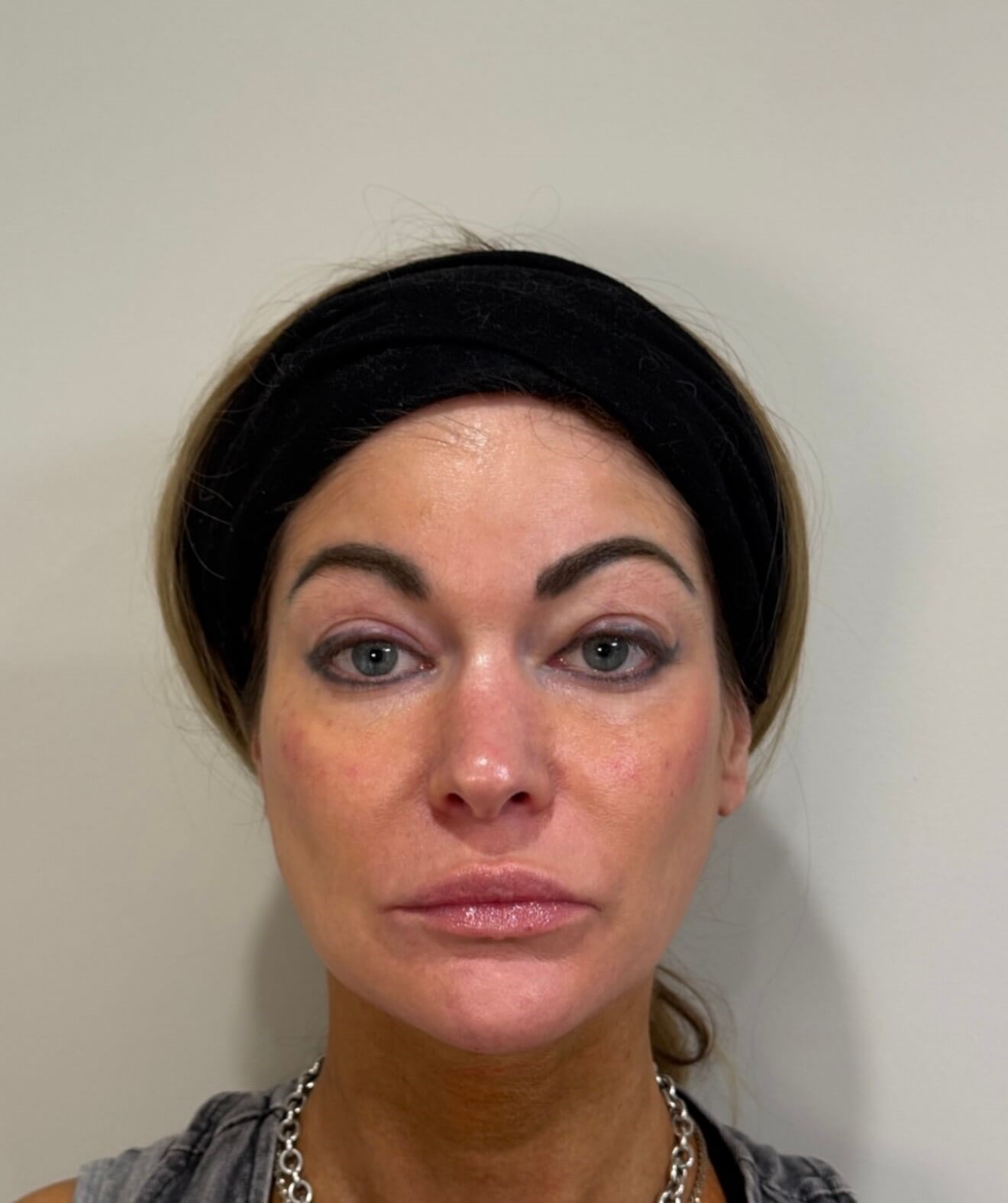 Balanced & Beautiful Results After