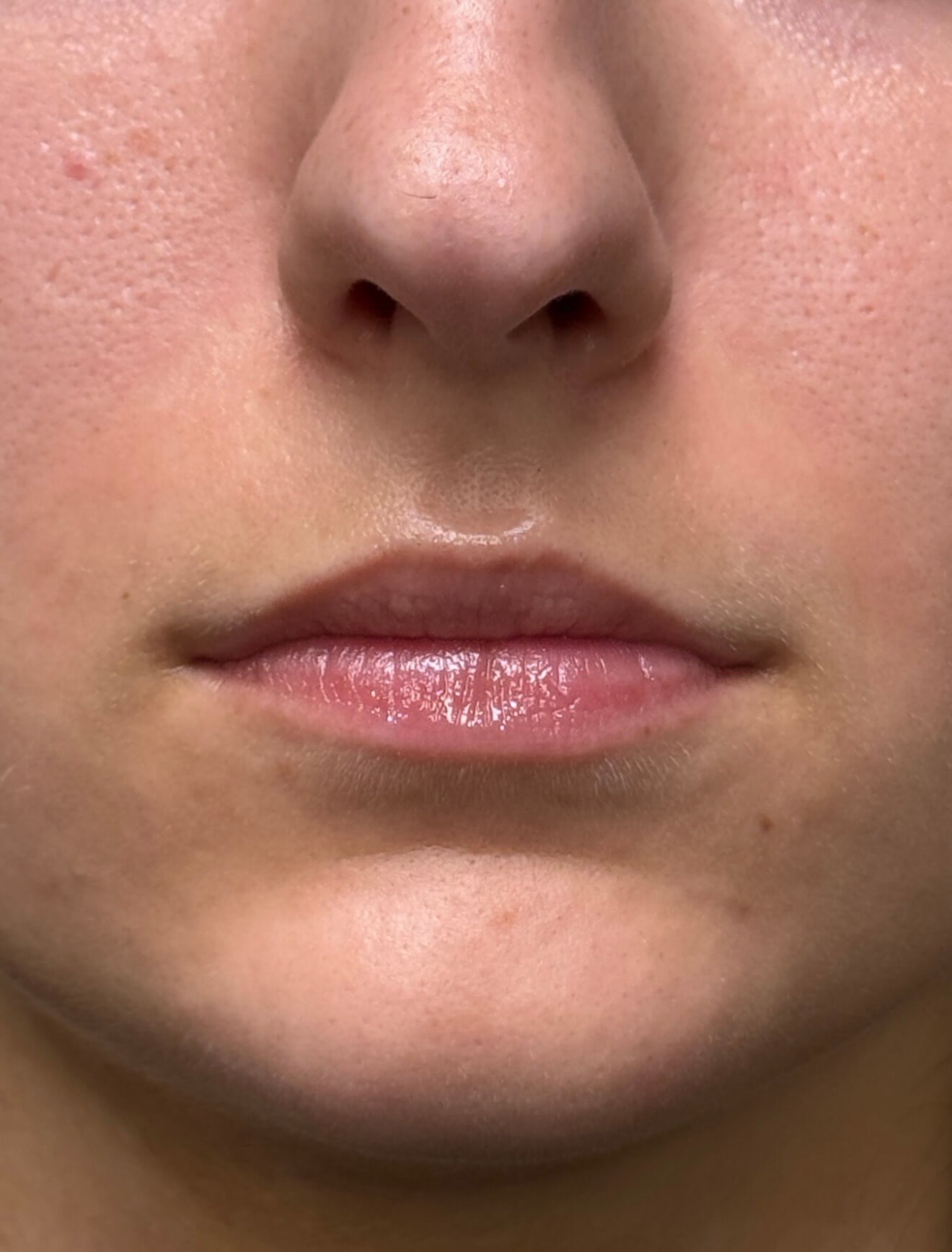 Soft, Hydrated Lips Before