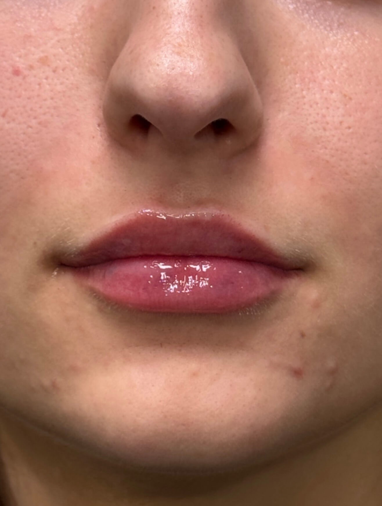 Soft, Hydrated Lips After