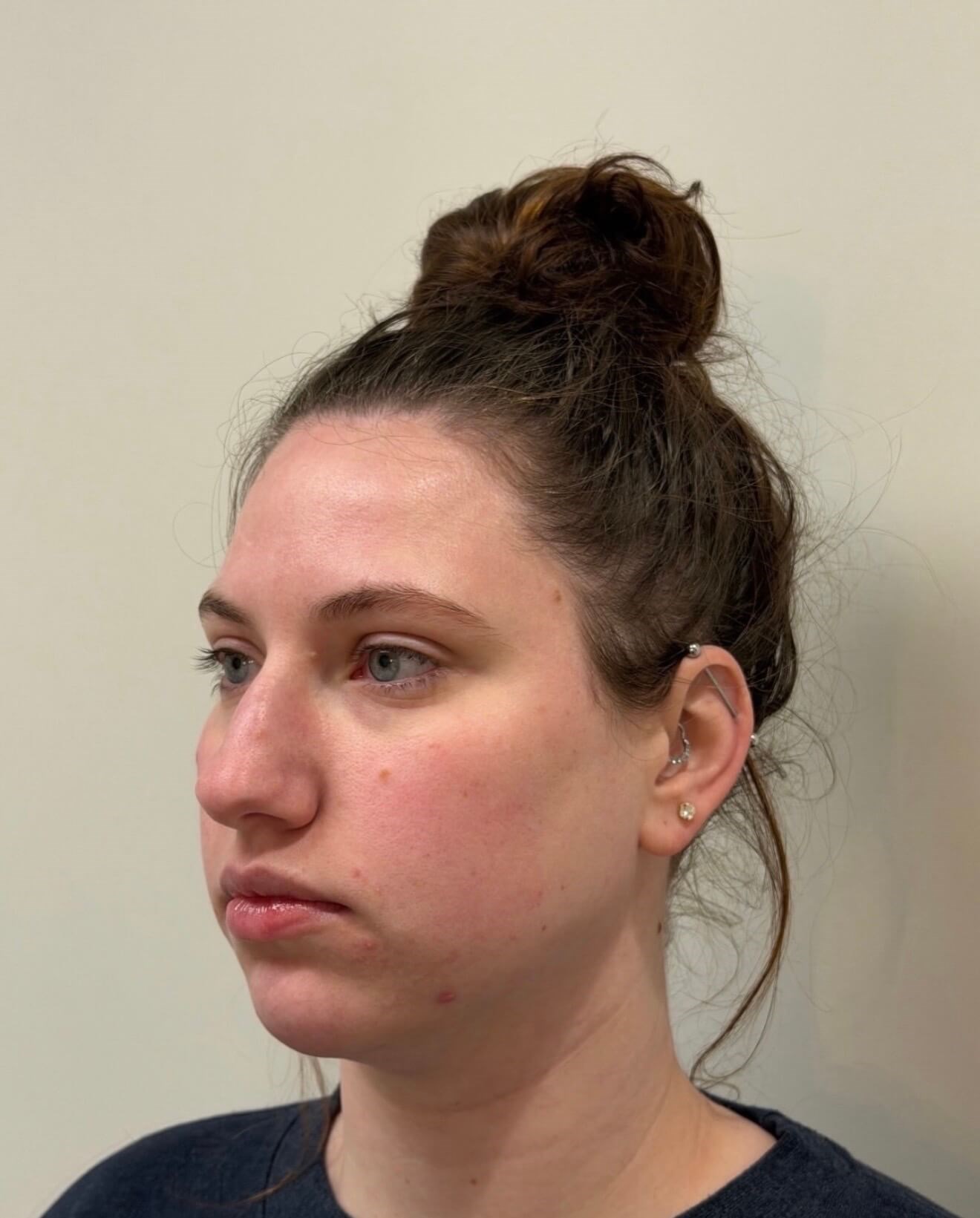 Natural Facial Harmony After