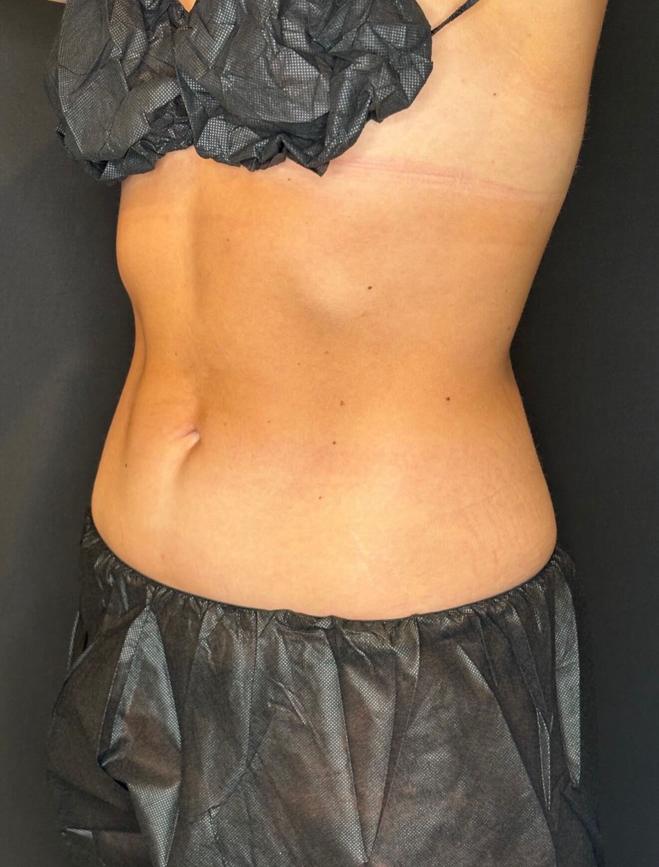 After Image