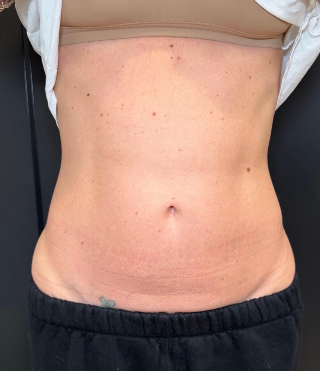 Refined Abs Reveal Before