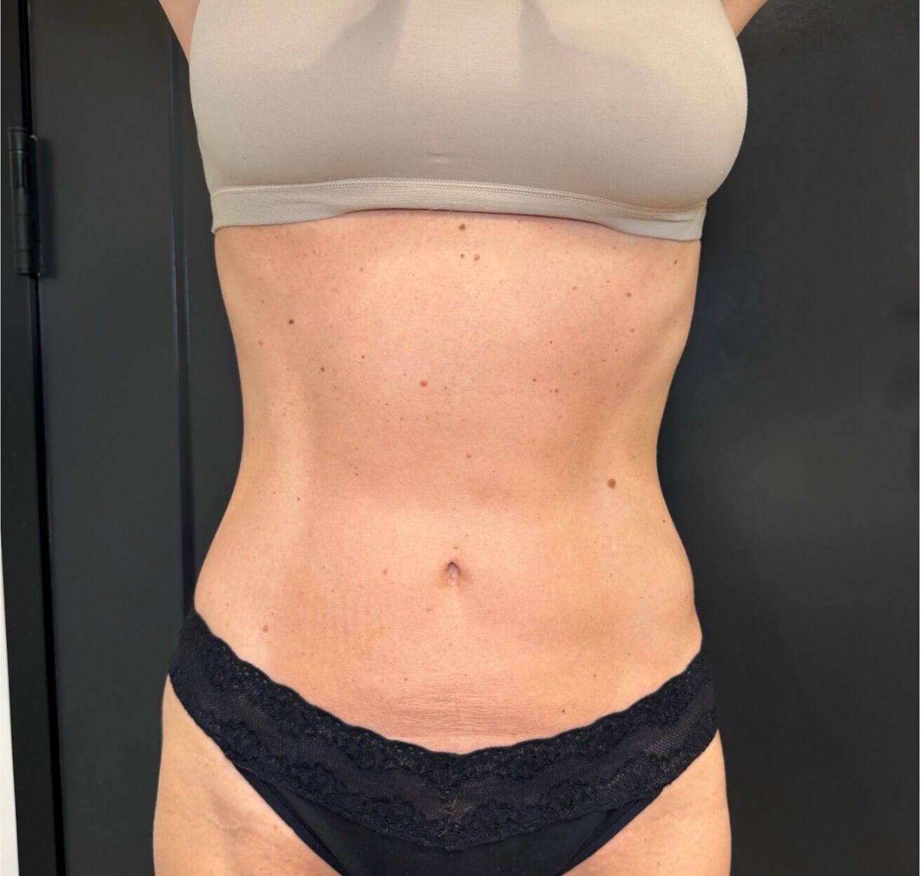 Refined Abs Reveal After