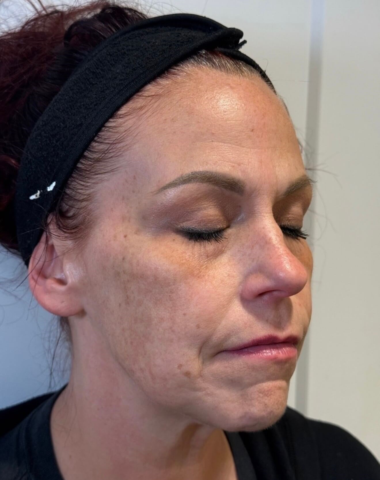 Radiant Skin: MOXI Renewal Before