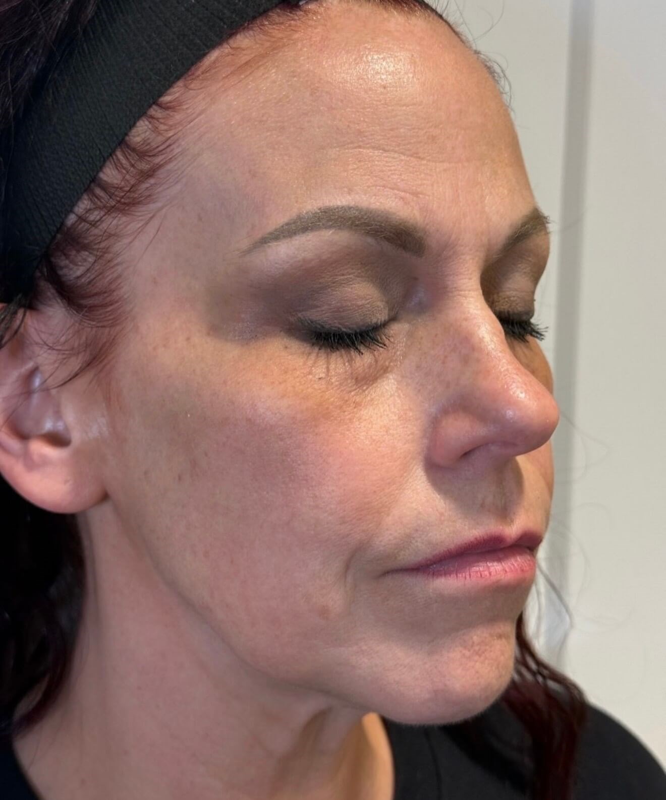 Radiant Skin: MOXI Renewal After
