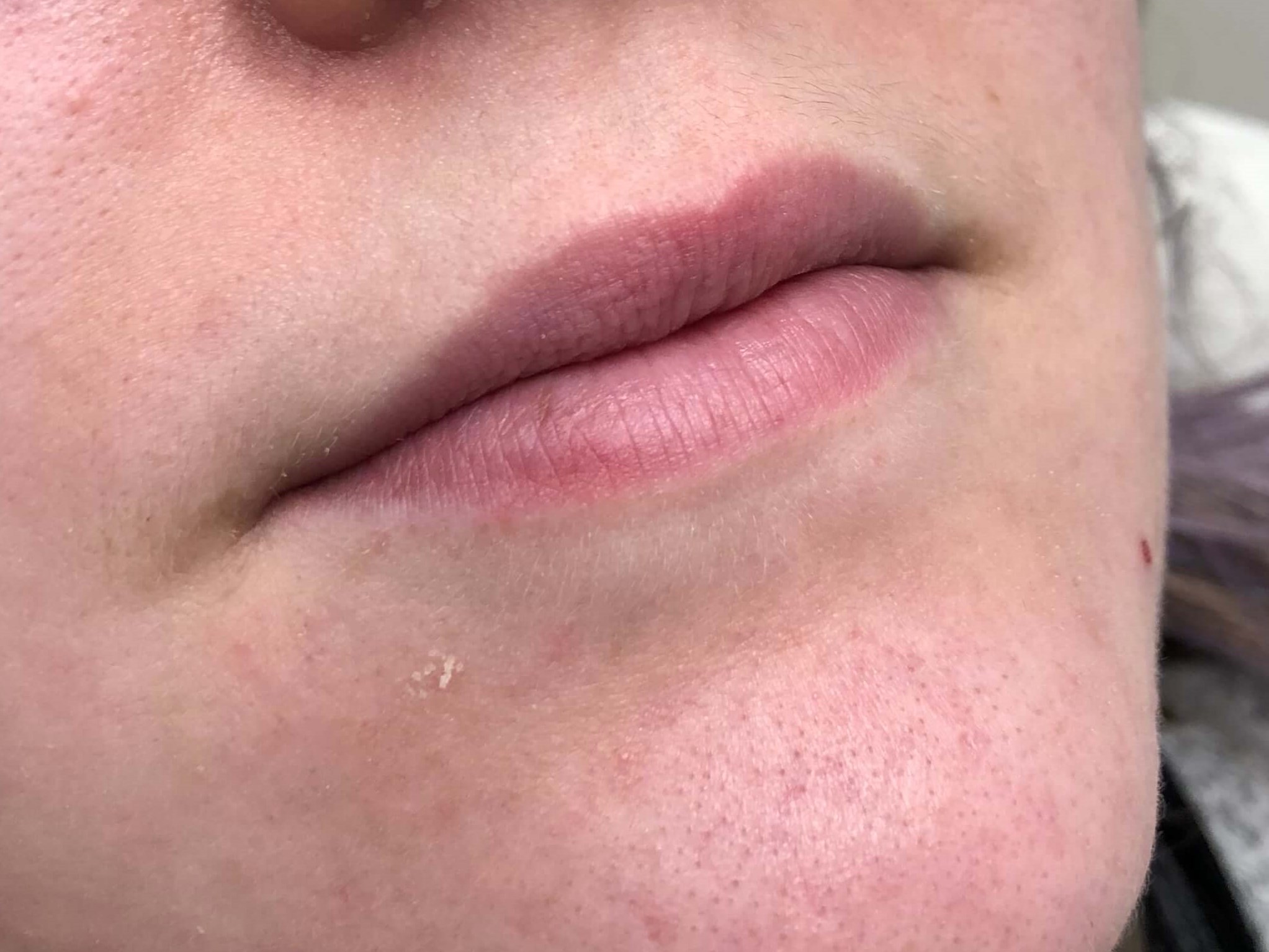 Before Image