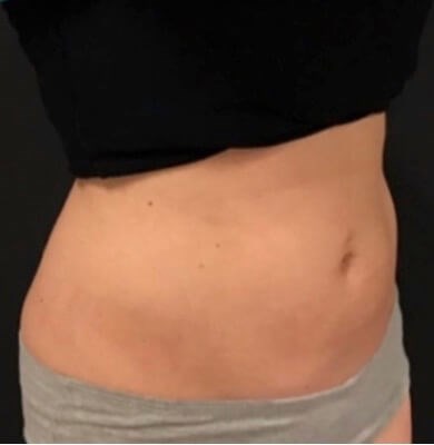 After Image