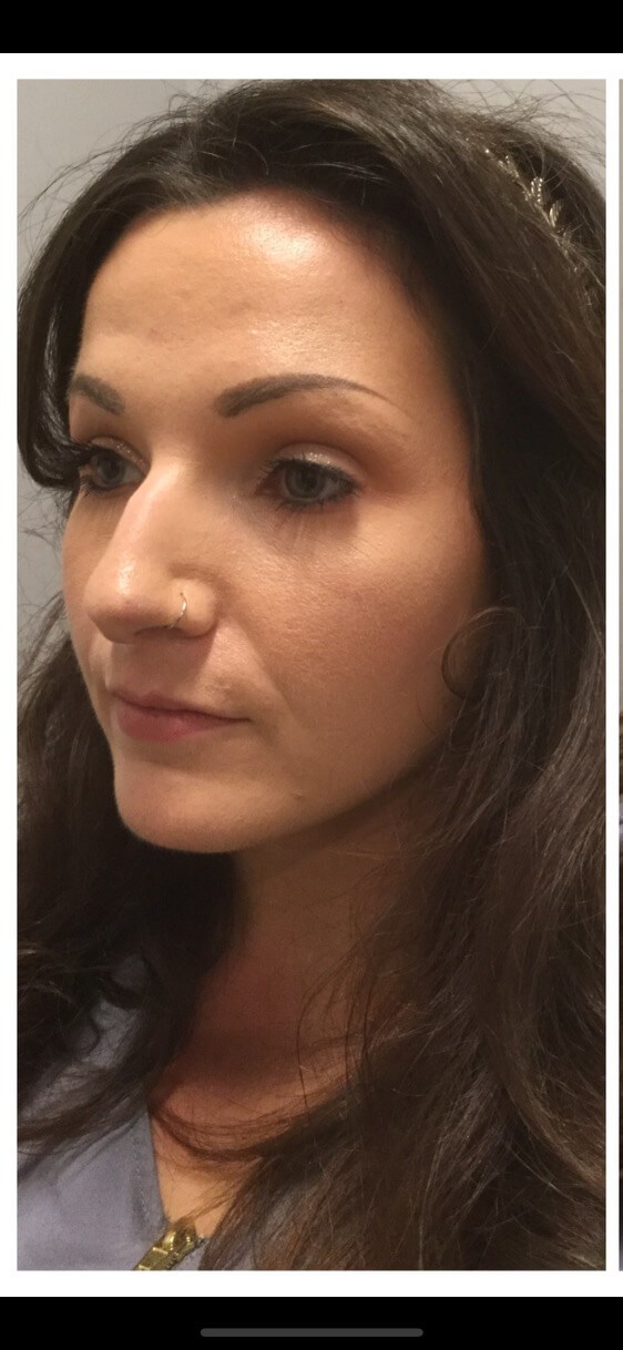 Before Image