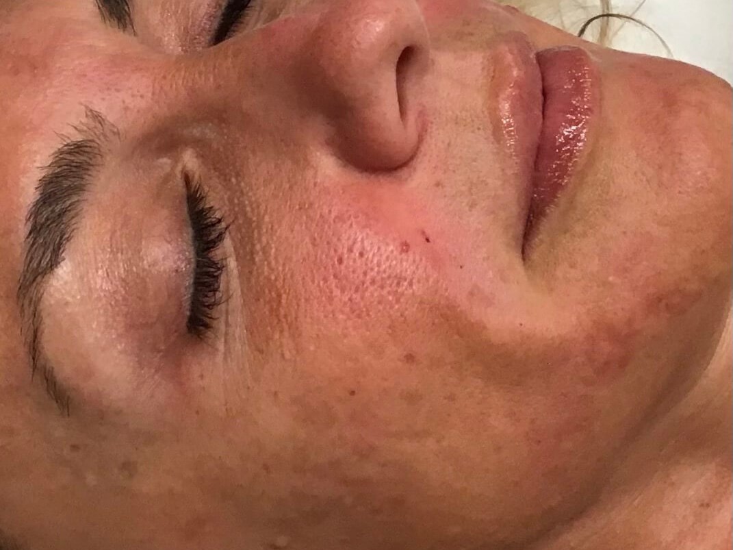 Before Image