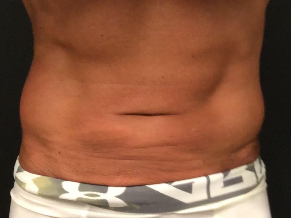 Before Image