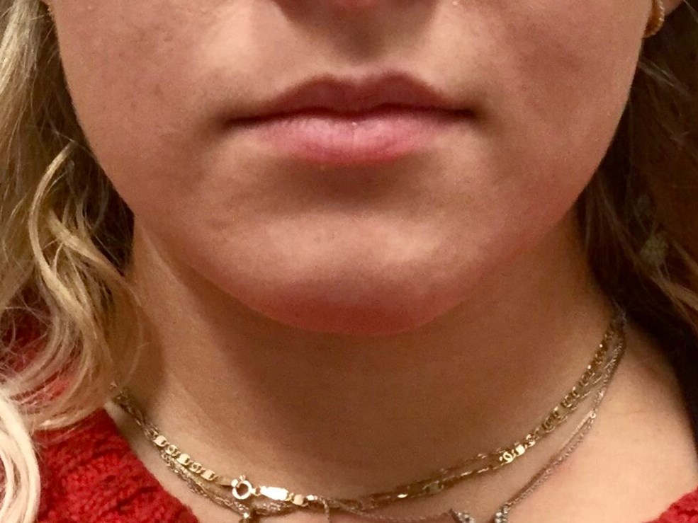 Before Image
