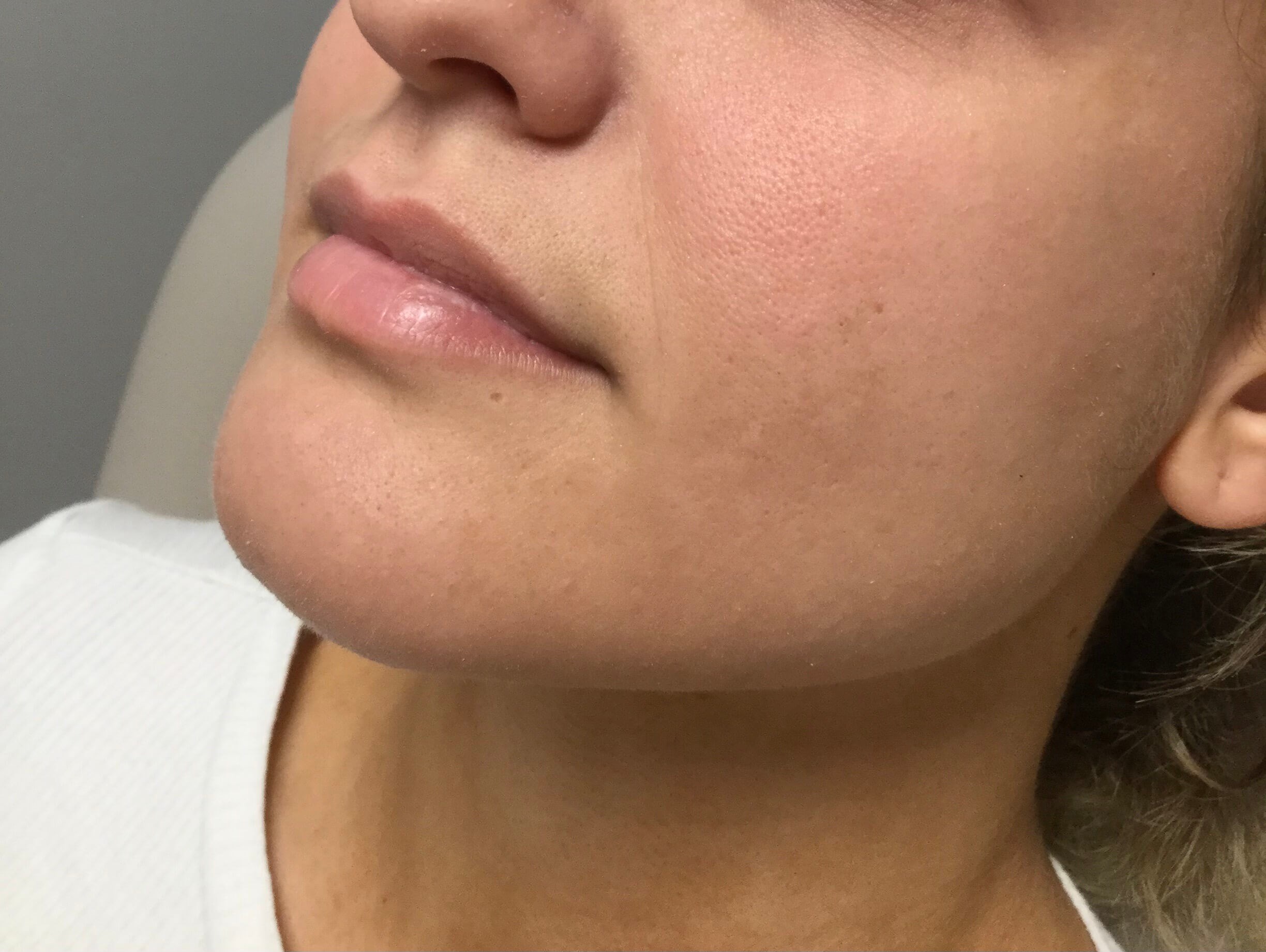 Before Image