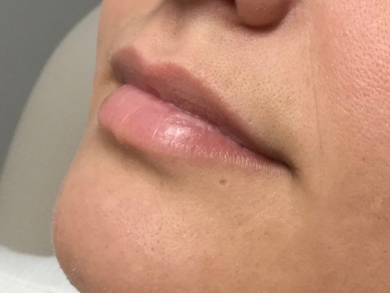 Before Image