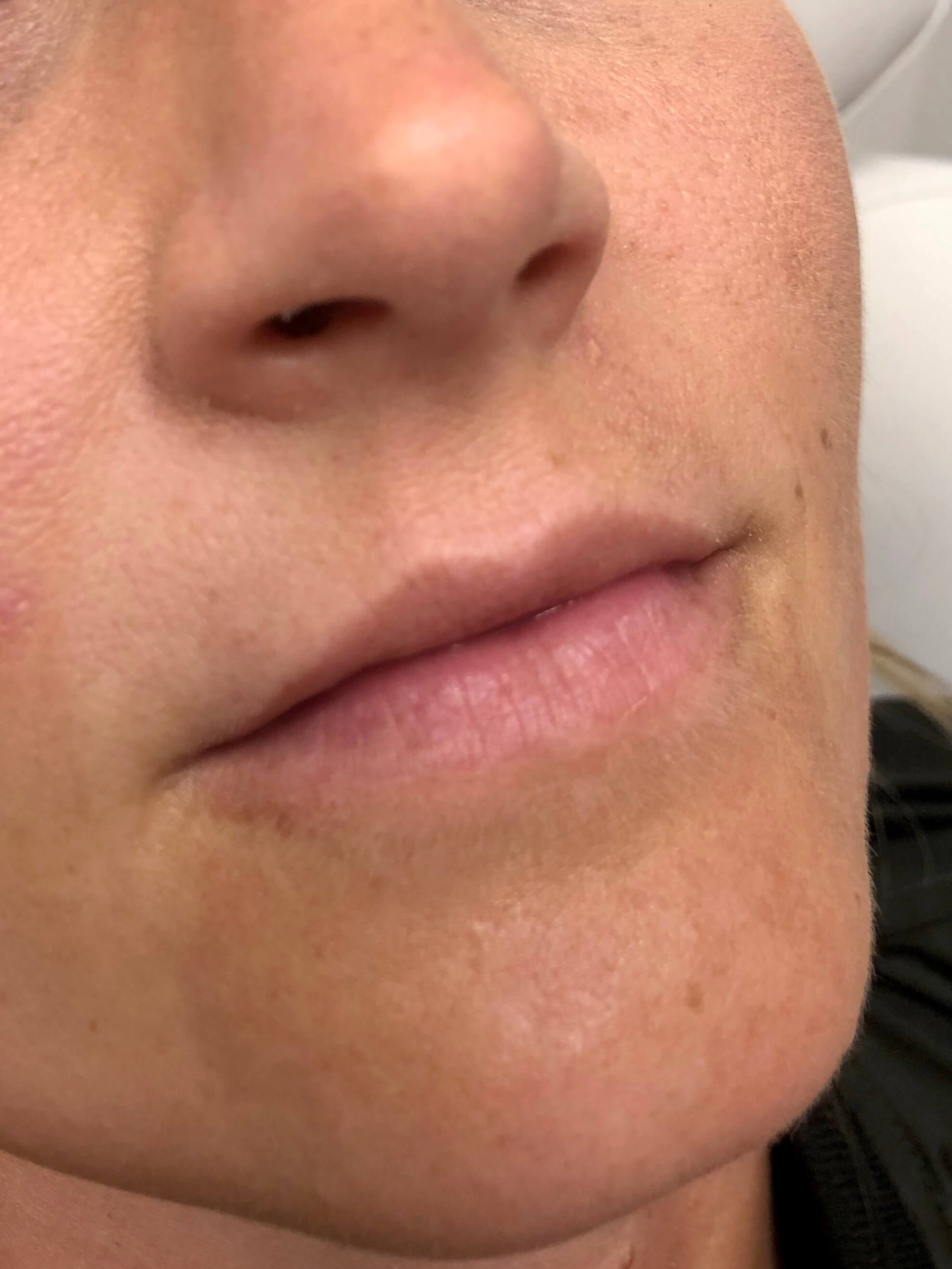 Before Image
