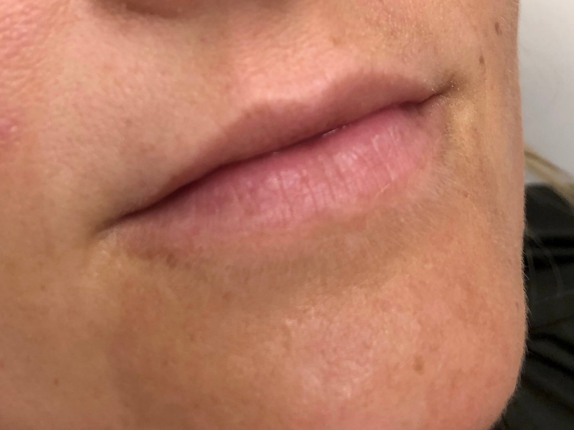 Before Image