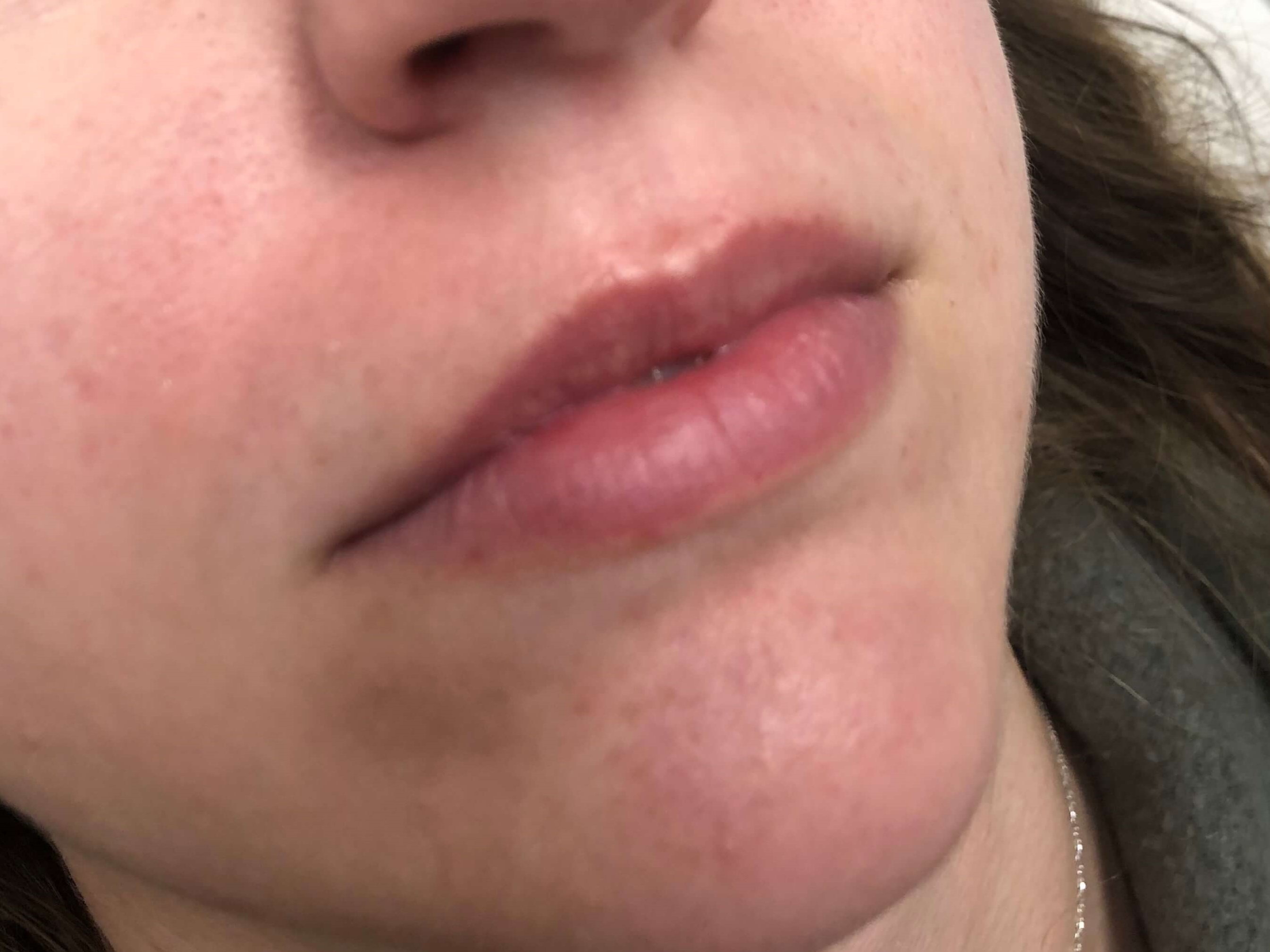 Before Image