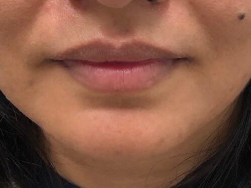 Before Image