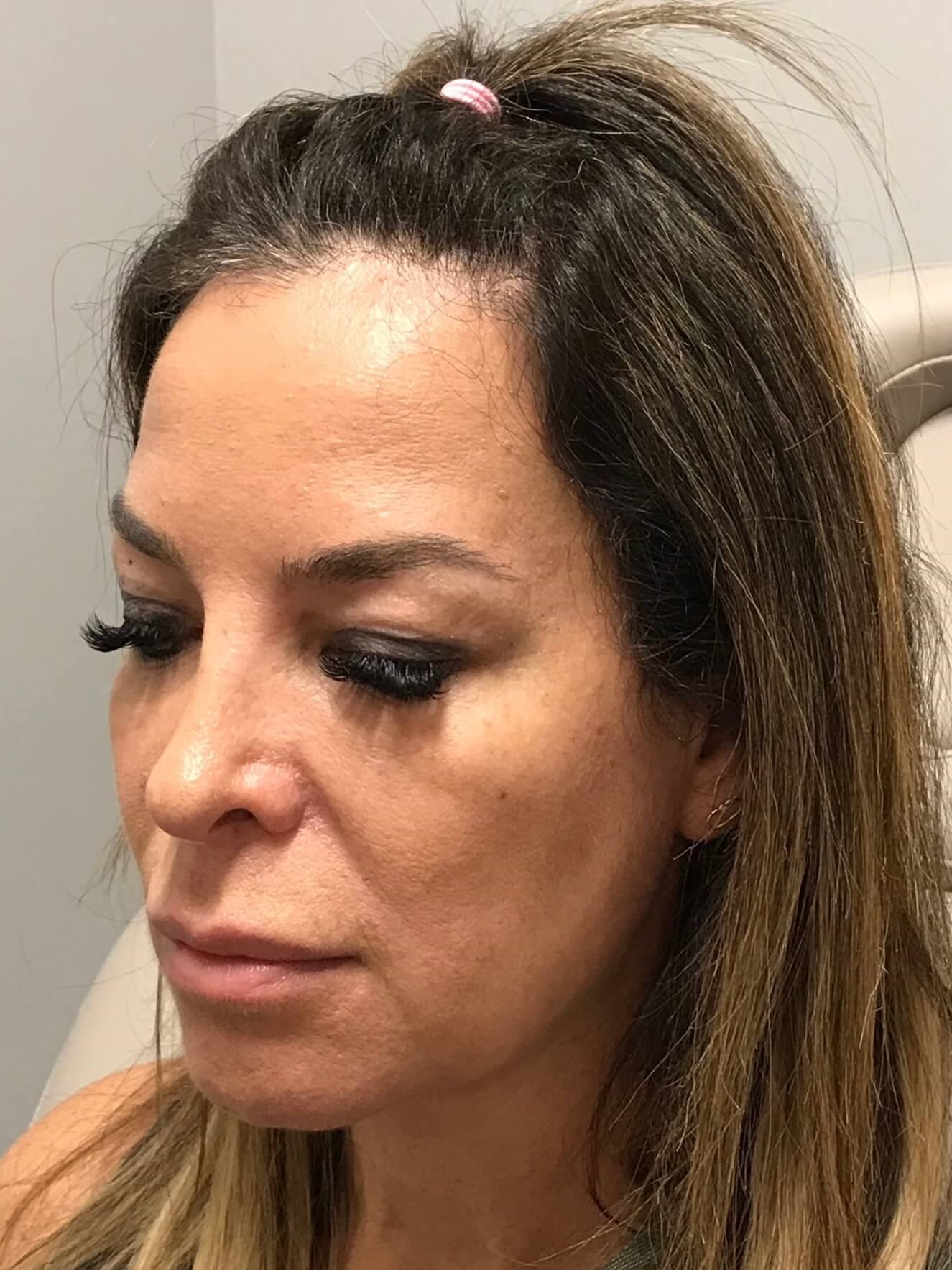 Before Image