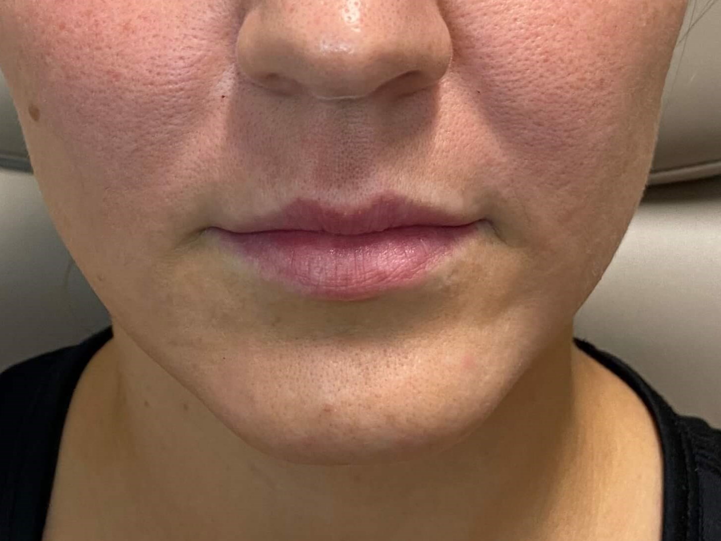 Before Image