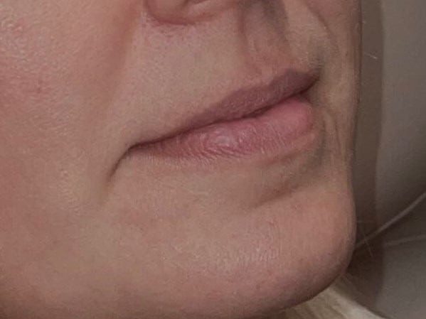 Before Image