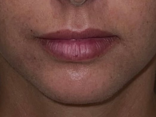 Before Image