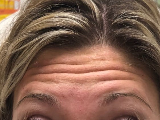 Before Image