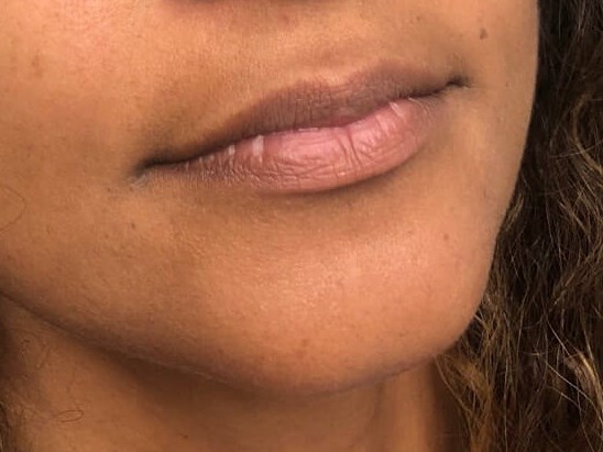Before Image