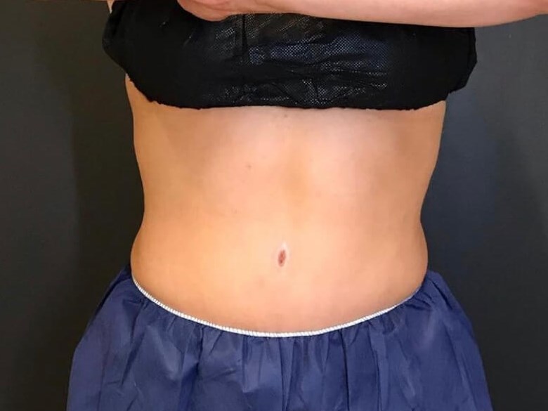 Before Image