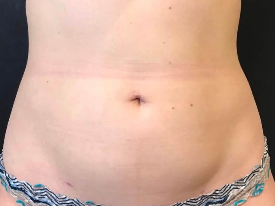 Before Image