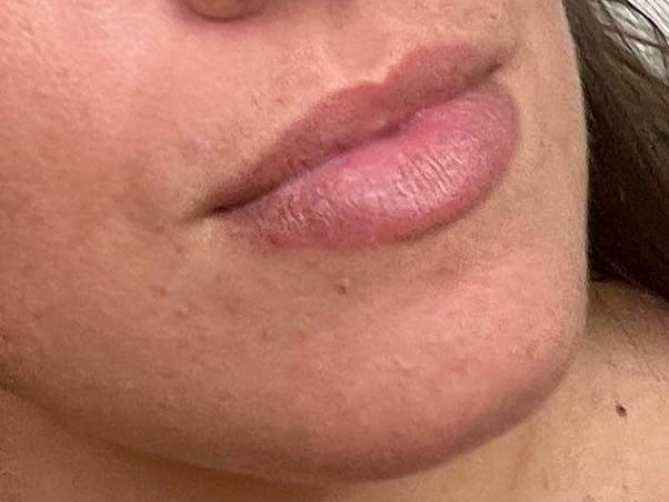 Before Image