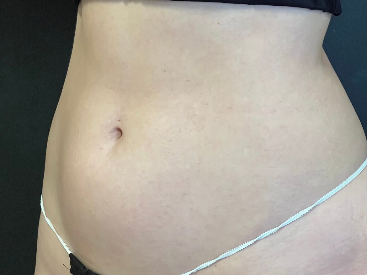 Before Image