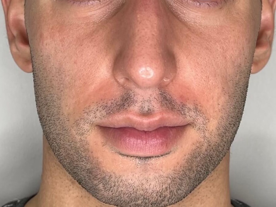 Before Image