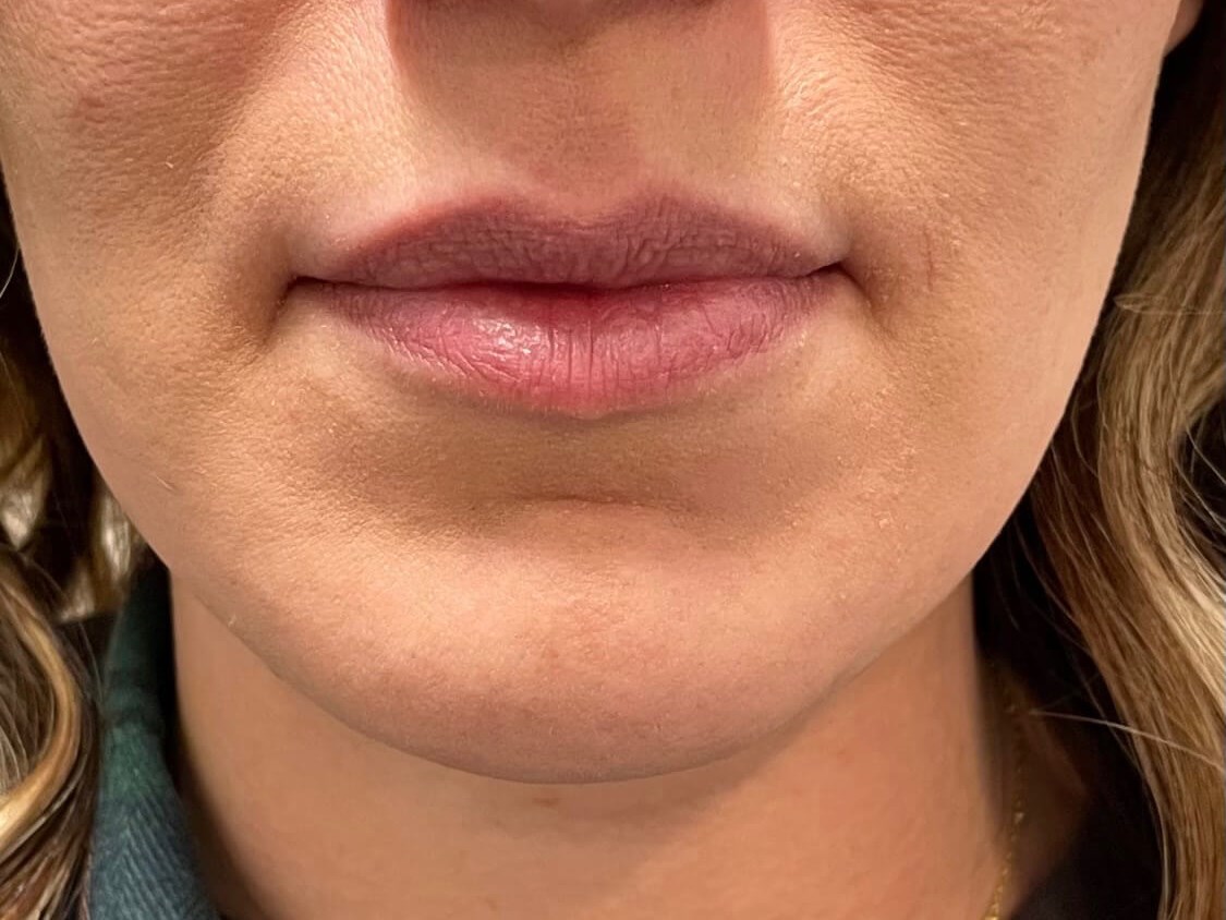 Before Image