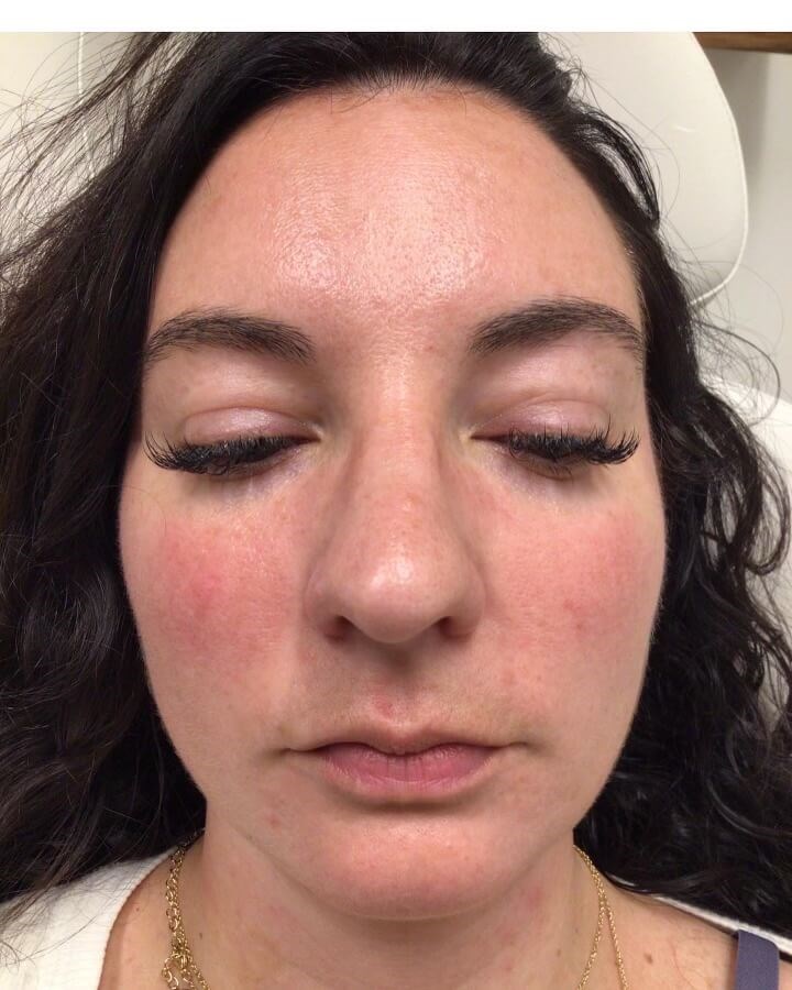 Before Image