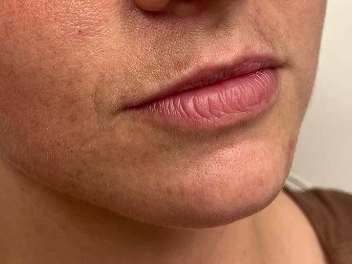 Before Image