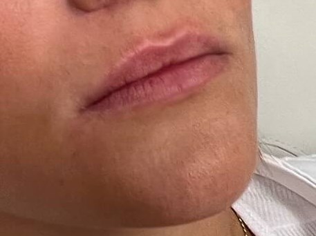 Before Image
