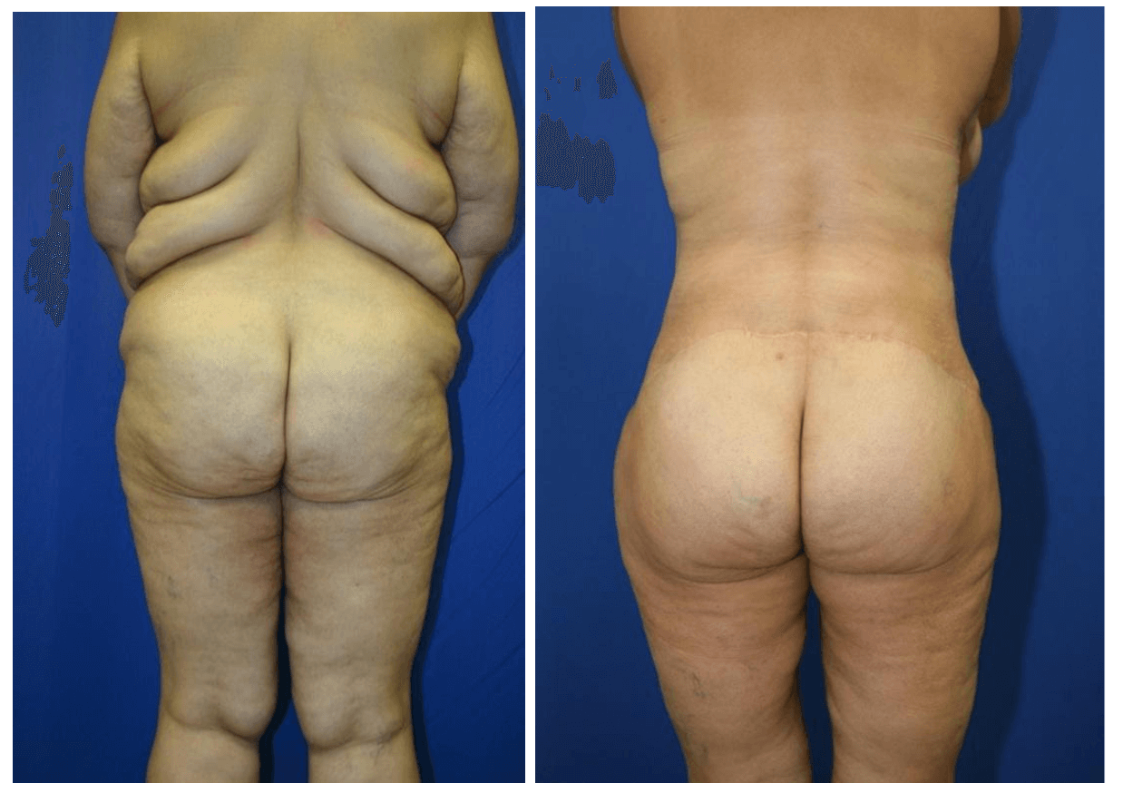 A New Way To Revamp Your Body